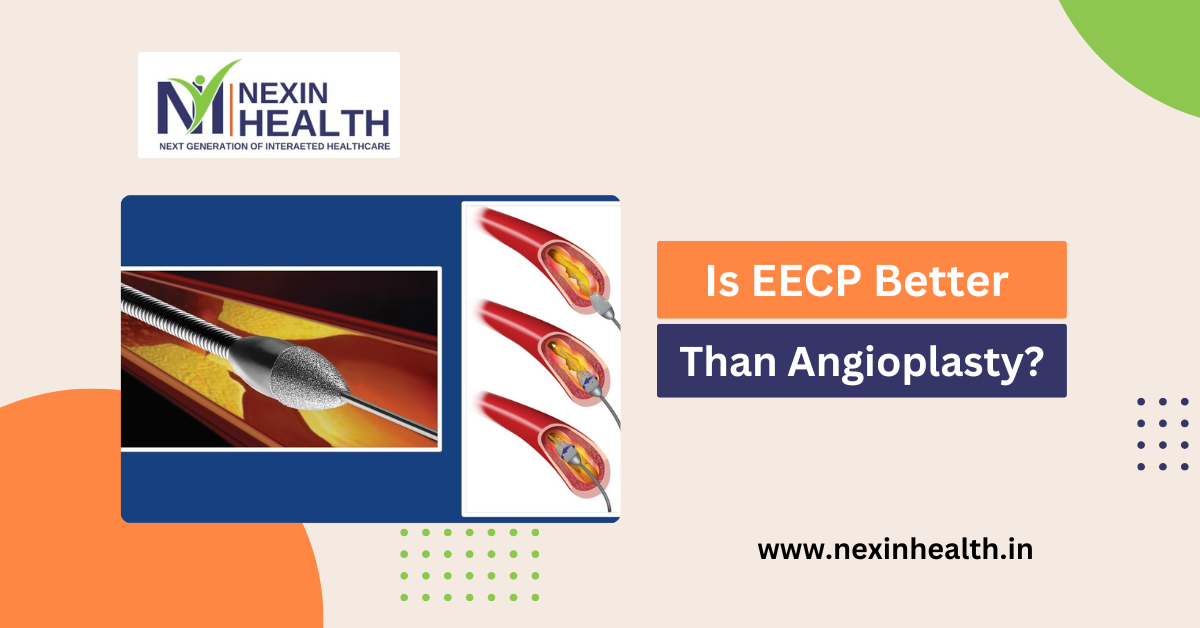Is EECP Better Than Angioplasty?