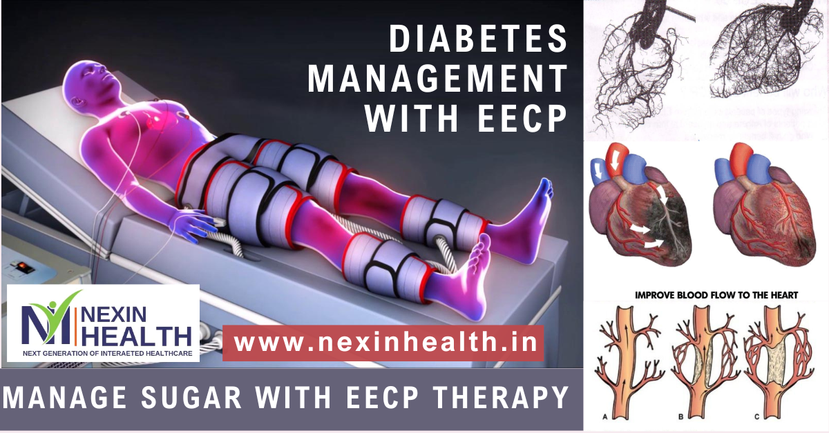 Diabetes Management with EECP Therapy: A Non-Invasive Approach