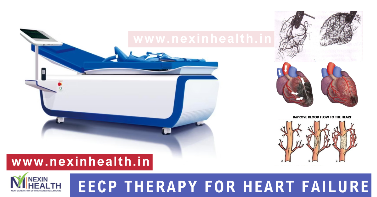EECP Therapy for Congestive Heart Failure