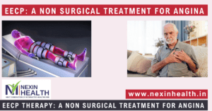 EECP A NON SURGICAL TREATMENT FOR ANGINA