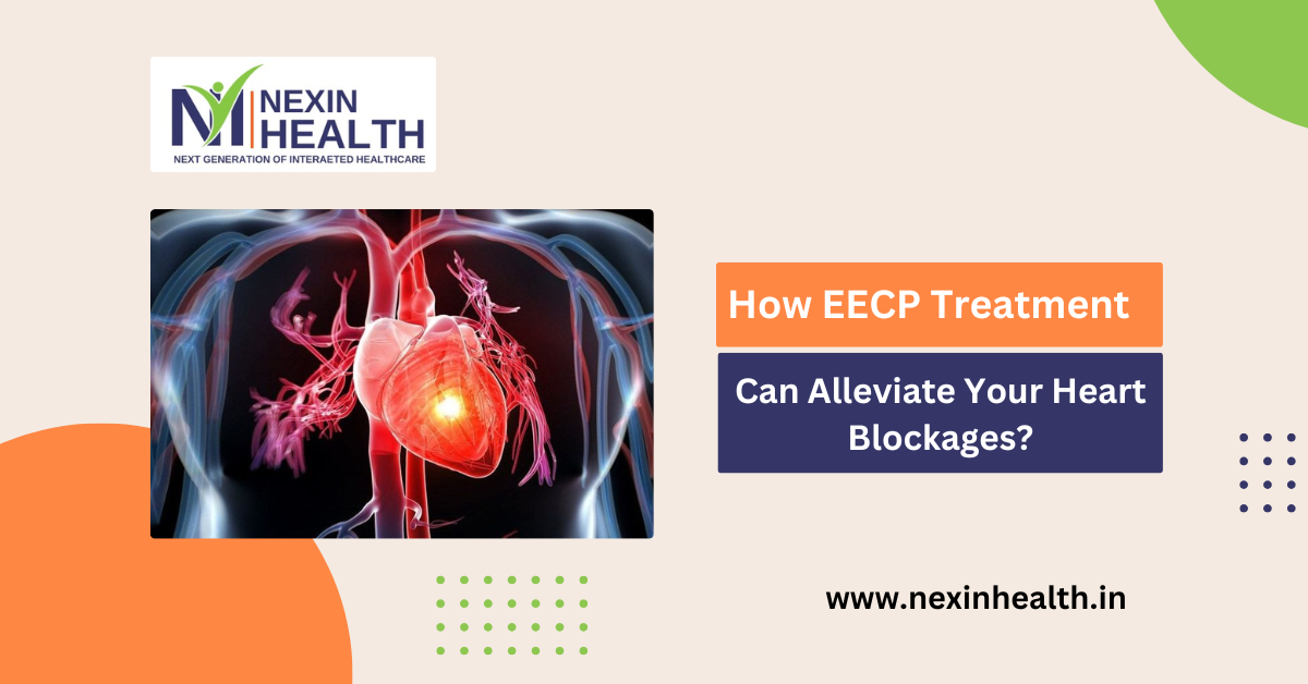 Natural Bypass Therapy: How EECP Treatment Can Alleviate Your Heart Blockages?
