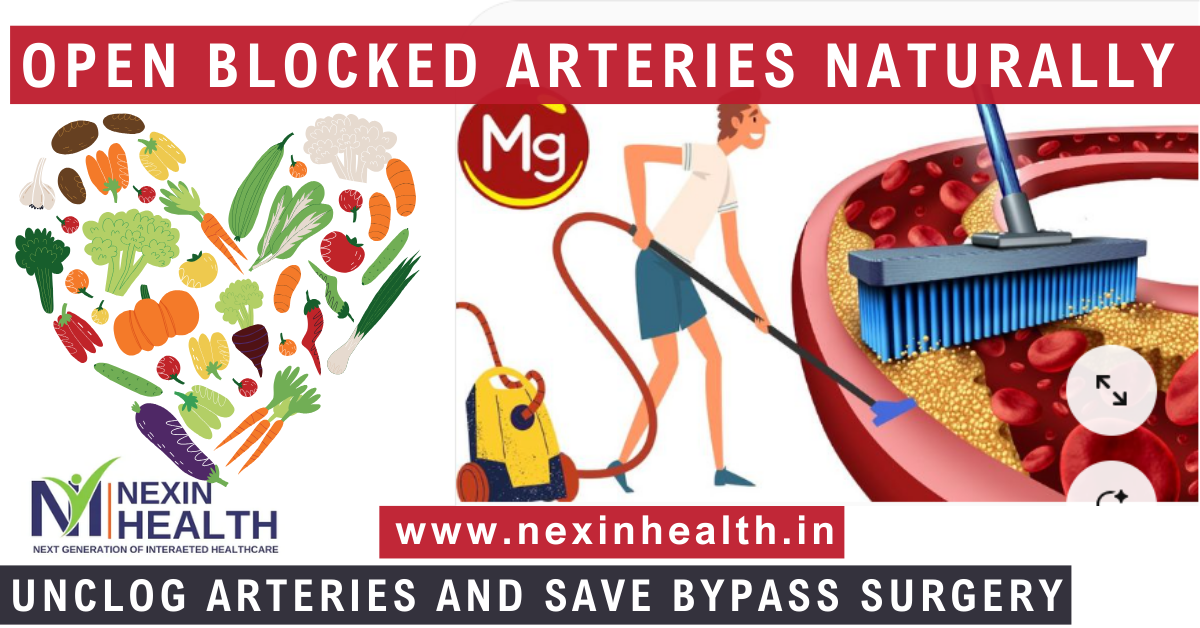 How to Open Coronary Blockages Naturally
