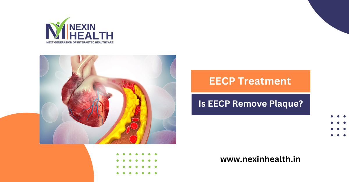 Is EECP Remove Plaque?