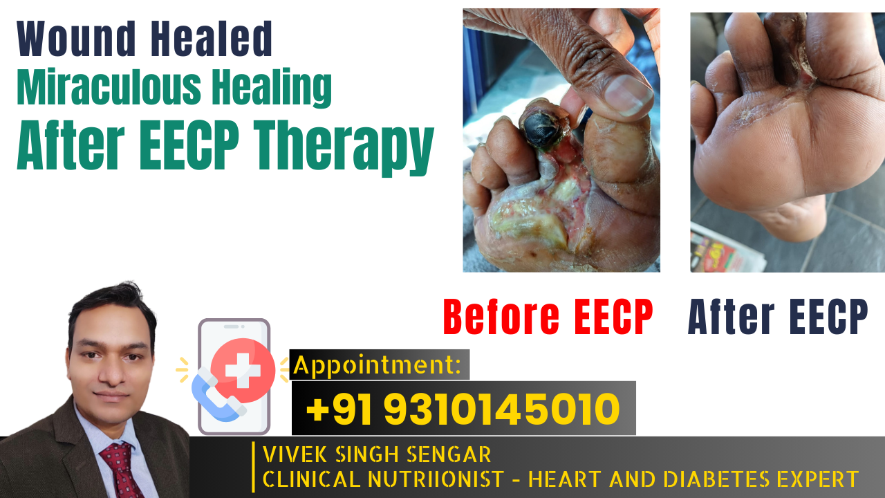 EECP Therapy for Wound Healing: A Miraculous Treatment to Prevent Amputation