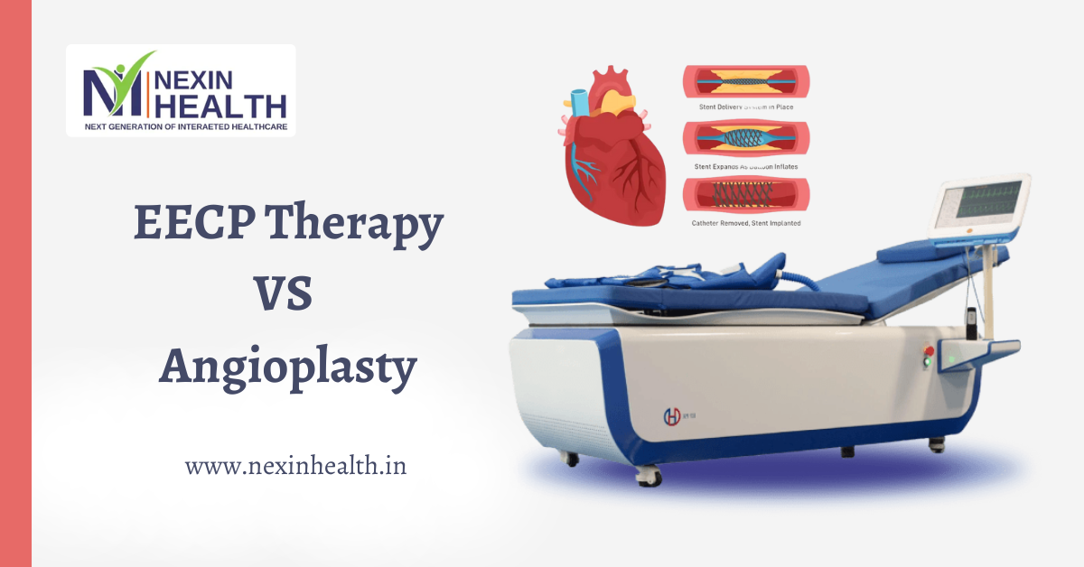 EECP Therapy vs. Angioplasty: Which is Better for Your Heart Health?