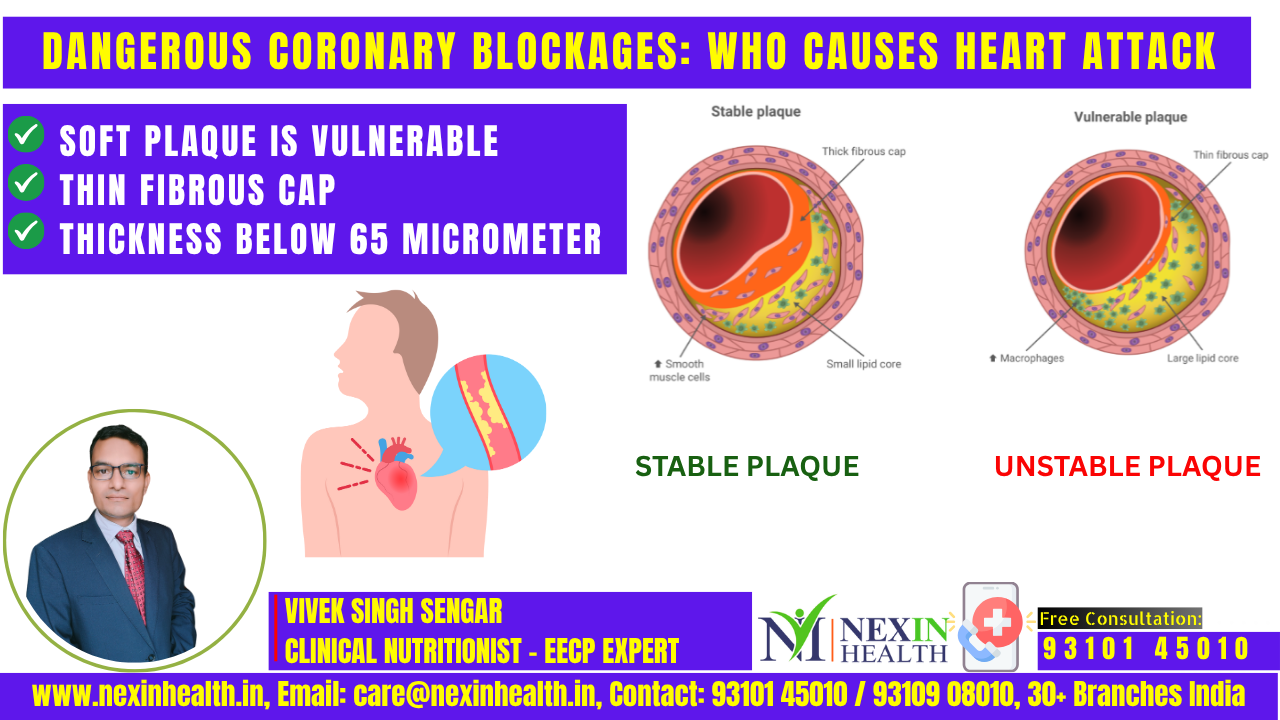 Dangerous Coronary Blockages: Which Type of Blockage Is Most Risky for the Heart Attack?
