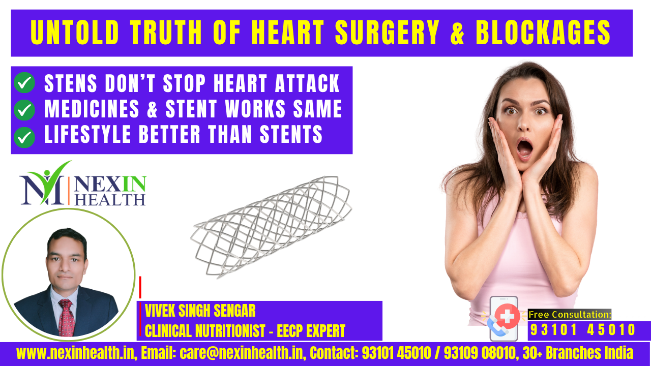 Untold Truth of Heart Surgery: Heart Attack or Heart Trap – The Untold Truth About Stents, Blockages, and the Medical Mafia