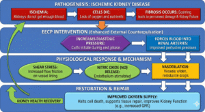 EECP Treatment for Kidney Failure flowchart